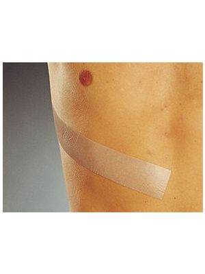 Molnlycke 293400 Mepiform Self-Adherent Dressing for Scar Reduction Sterile 10cm x 18cm Each 